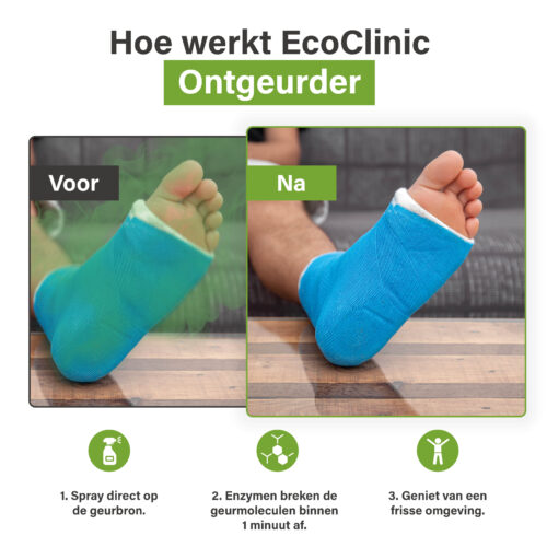 Voor-en-na-afbeelding van een voet in een blauw gipsverband, waarbij EcoClinic Ontgeurder wordt gebruikt om geur te verwijderen.